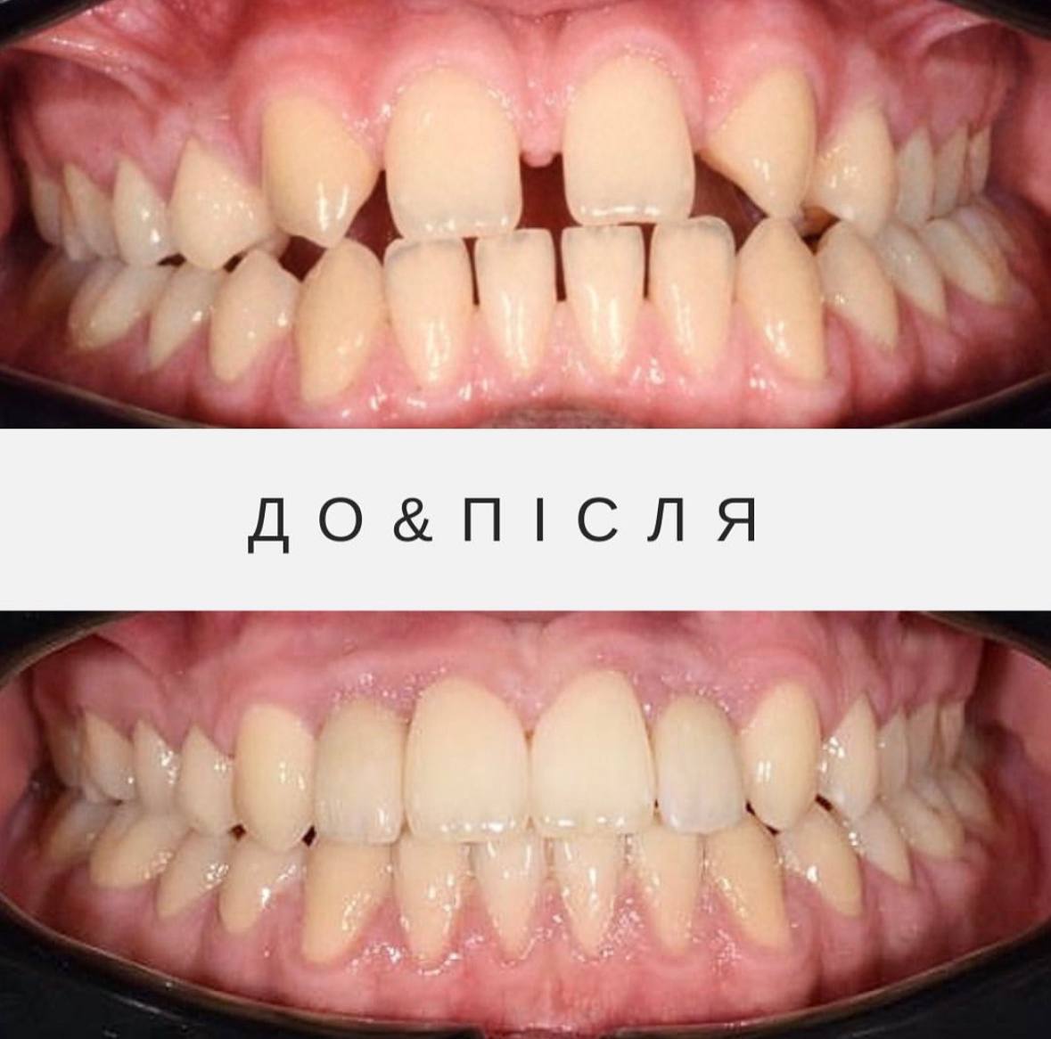 Результати лікування 1