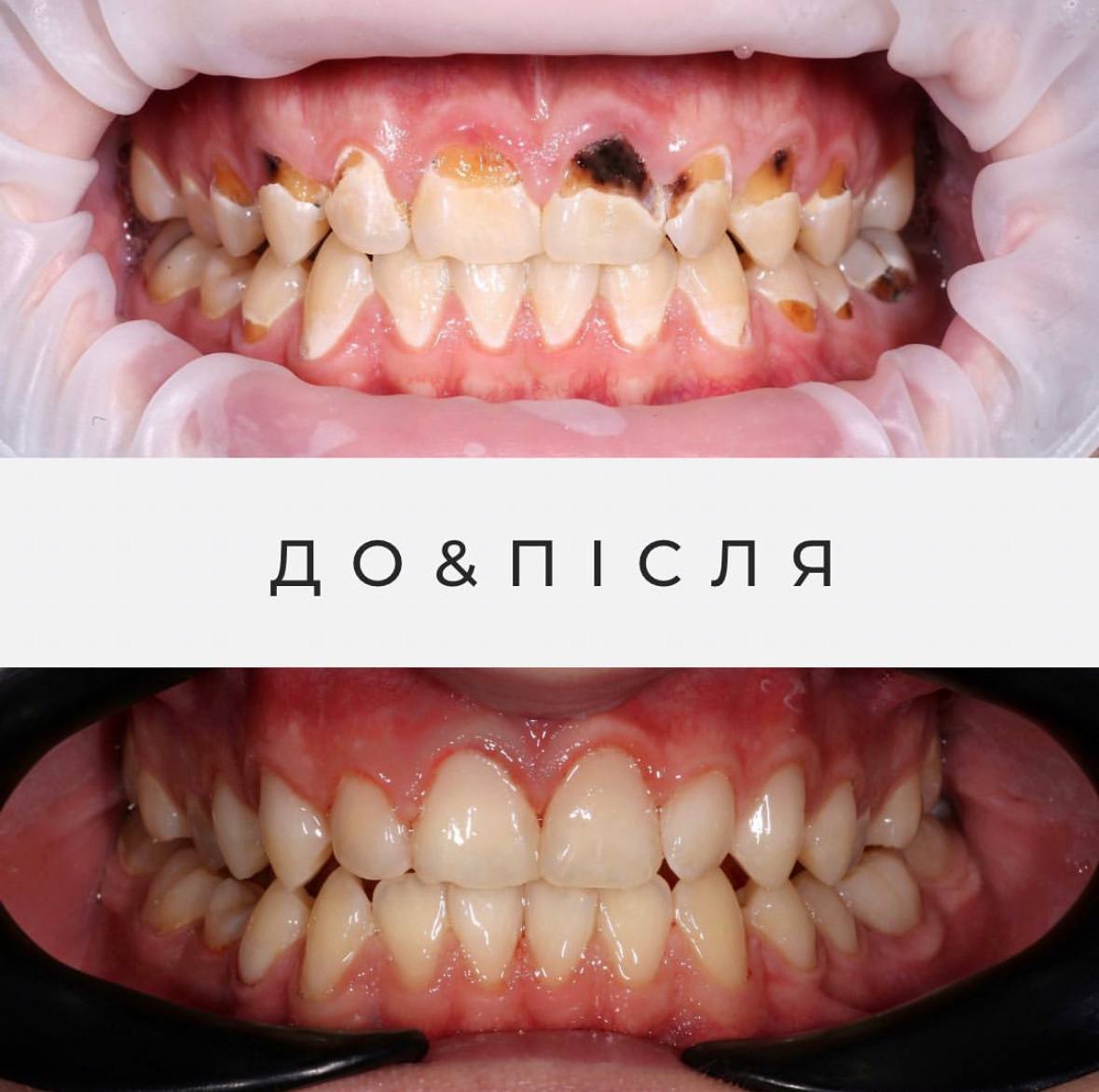 Результати лікування 3