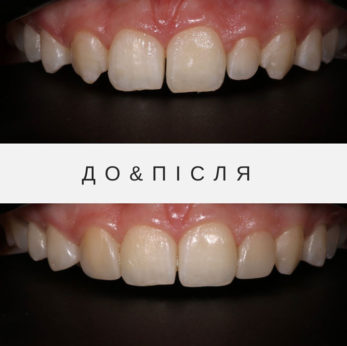 Результати лікування 7