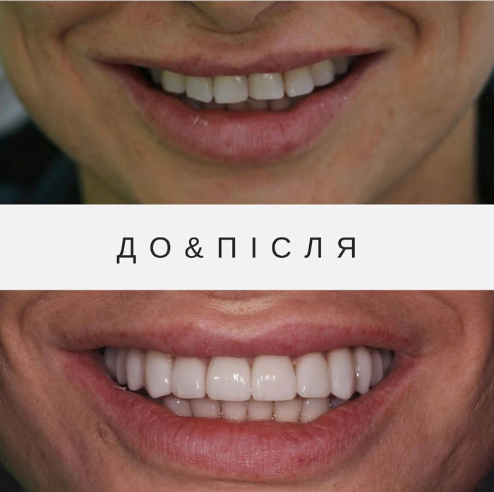 Результати лікування 8